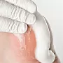 Пенный кератолитик с мочевиной и молочной кислотой, 150 мл №9875